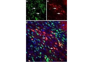 Expression of Neuropilin-2 in mouse substantia nigra pars compacta - Immunohistochemical staining of perfusion-fixed frozen mouse brain sections using Anti-Neuropilin-2 (NRP2) (extracellular) Antibody (ABIN7043380, ABIN7044700 and ABIN7044701), (1:400). (NRP2 anticorps  (Extracellular, N-Term))