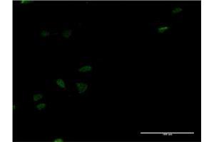 Immunofluorescence of monoclonal antibody to LEF1 on HeLa cell. (LEF1 anticorps  (AA 33-138))
