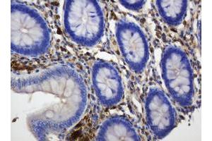 Image no. 11 for anti-Thymidine Phosphorylase (TYMP) (AA 311-482) antibody (ABIN1491396)