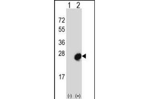 Western blot analysis of MID1IP1 (arrow) using rabbit polyclonal MID1IP1 Antibody (N-term) (ABIN656689 and ABIN2845926). (m1ip1 anticorps  (N-Term))