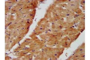 IHC image of ABIN7160937 diluted at 1:400 and staining in paraffin-embedded human heart tissue performed on a Leica BondTM system. (NDUFB8 anticorps  (AA 29-132))
