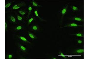 Immunofluorescence of purified MaxPab antibody to ZNF124 on HeLa cell. (ZNF124 anticorps  (AA 1-289))