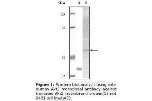 Image no. 1 for anti-V-Akt Murine Thymoma Viral Oncogene Homolog 2 (AKT2) antibody (ABIN232107) (AKT2 anticorps)