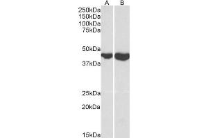 ABIN1782132 (0. (GOT2 anticorps  (Internal Region))