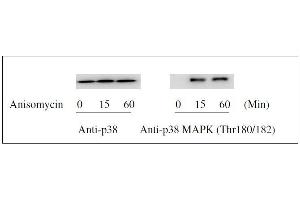 Western blot analysis of extracts from 1 μg/mL Anisomycin treated Hela cells.