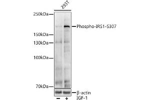 Western blot analysis of extracts of various cell lines, using Phospho-IRS1-S307 antibody (ABIN6135245, ABIN6136114, ABIN6136115 and ABIN6225577) at 1:1000 dilution. (IRS1 anticorps  (pSer307))