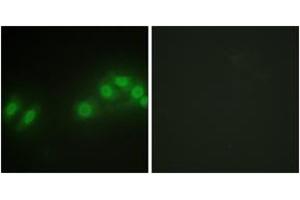 Immunofluorescence analysis of HepG2 cells, using LATS2 Antibody. (LATS2 anticorps  (AA 541-590))