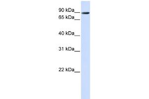 WB Suggested Anti-TMEM16K Antibody Titration:  0. (Anoctamin 10 anticorps  (C-Term))