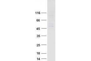Validation with Western Blot