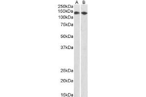 ABIN2561628 (0. (CCAR2 anticorps  (AA 842-855))