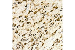 Immunohistochemistry of paraffin-embedded mouse brain using RPL10A Rabbit mAb (ABIN7269992) at dilution of 1:25 (40x lens). (RPL10A anticorps)