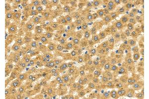 ABIN6265123 and ABIN6276491 at 1/100 staining Rat liver tissue by IHC-P.