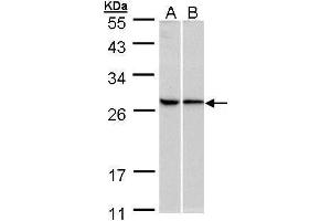 WB Image Sample (30 ug of whole cell lysate) A:293T B:HeLa 10% SDS PAGE antibody diluted at 1:500 (RPL13A anticorps)
