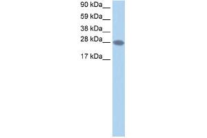 WB Suggested Anti-TCEA2 Antibody Titration:  1. (TCEA2 anticorps  (N-Term))