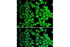 Immunofluorescence analysis of HeLa cells using SDHA Polyclonal Antibody (SDHA anticorps)