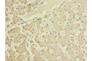Immunohistochemistry of paraffin-embedded human liver tissue using ABIN7165639 at dilution of 1:100 (HOOK2 anticorps  (AA 440-719))