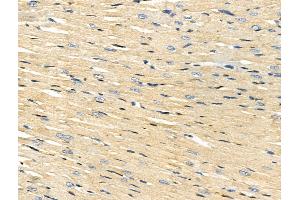ABIN7093197 and ABIN7097208 at 1/100 staining Rat heart tissue by IHC-P. (ACSS1 anticorps)