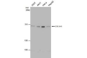 WB Image COL3A1 antibody [C2C3], C-term detects COL3A1 protein by western blot analysis. (COL3A1 anticorps  (C-Term))