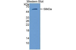 Western Blotting (WB) image for anti-Glucosidase, Beta, Acid (GBA) (AA 255-509) antibody (ABIN3205108) (GBA anticorps  (AA 255-509))