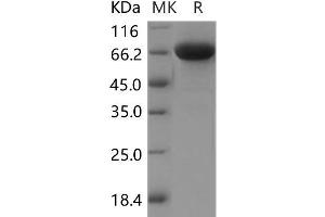 Western Blotting (WB) image for Immunoglobulin Superfamily, Member 8 (IGSF8) protein (His tag) (ABIN7320064)