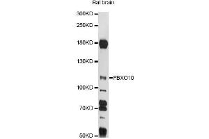 Western blot analysis of extracts of rat brain, using FBXO10 antibody (ABIN6292076) at 1:1000 dilution.