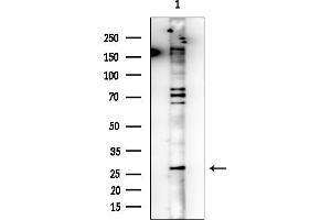 anti-Kruppel-Like Factor 6 (KLF6) (Internal Region) antibody