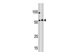 Western blot analysis of PKMYT1 polyclonal antibody  in A-375 (left) and Y-79 (right) cell line lysate. (PKMYT1 anticorps  (C-Term))