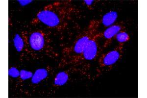 Proximity Ligation Analysis of protein-protein interactions between AKT1 and CDKN1A.