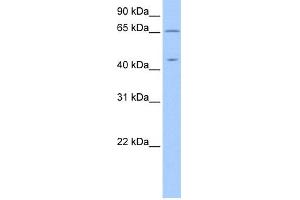 WB Suggested Anti-ZPLD1 Antibody Titration: 0. (ZPLD1 anticorps  (C-Term))