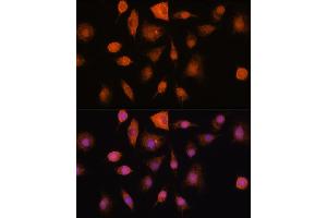anti-Ribonuclease/angiogenin Inhibitor 1 (RNH1) (AA 202-461) antibody