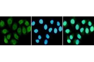 Immunocytochemistry staining of HeLa cells fixed in 1 % Paraformaldehyde and using R mouse mAb (dilution 1:100).
