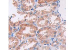 IHC-P analysis of kidney tissue, with DAB staining. (ACTN1 anticorps  (AA 28-260))