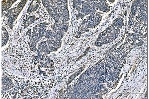 IHC analysis of DYNLL1/PIN using anti-DYNLL1/PIN antibody (ABIN7599570).