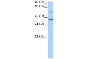 WB Suggested Anti-SERTAD2 Antibody Titration:  0. (SERTAD2 anticorps  (N-Term))
