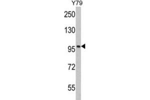 Western Blotting (WB) image for anti-Karyopherin (Importin) beta 1 (KPNB1) antibody (ABIN3002817) (KPNB1 anticorps)