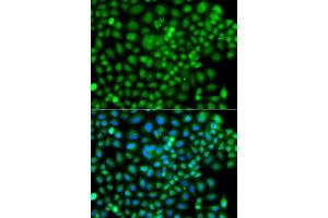 Immunofluorescence analysis of A549 cells using SUMO4 antibody (ABIN5975591). (SUMO4 anticorps)