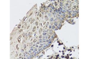 Immunohistochemistry of paraffin-embedded Human esophagus using GBF1 Polyclonal Antibody at dilution of 1:100 (40x lens). (GBF1 anticorps)