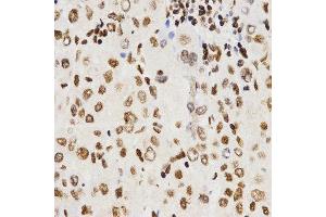 Immunohistochemistry (IHC) image for anti-Histone H3 (H3) (C-Term) antibody (ABIN3023243) (Histone 3 anticorps  (C-Term))