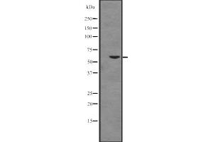 Western blot analysis of Cytochrome P450 17A1 expression in K562 cell line lysates ,The lane on the left is treated with the antigen-specific peptide. (CYP17A1 anticorps  (Internal Region))