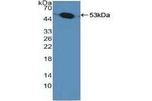 Detection of Recombinant PSMC1, Human using Polyclonal Antibody to Proteasome 26S Subunit, ATPase 1 (PSMC1) (PSMC1 anticorps  (AA 1-440))