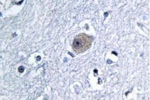 Image no. 2 for anti-Bone Morphogenetic Protein 8A (BMP8A) antibody (ABIN317821) (BMP8A anticorps)
