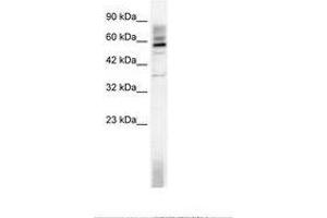 Image no. 1 for anti-TAF15 RNA Polymerase II, TATA Box Binding Protein (TBP)-Associated Factor, 68kDa (TAF15) (AA 183-232) antibody (ABIN202793) (TAF15 anticorps  (AA 183-232))