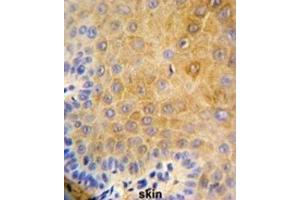 Immunohistochemistry (IHC) image for anti-Keratin 9 (KRT9) antibody (ABIN3003129) (KRT9 anticorps)