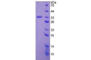 SDS-PAGE analysis of Human ADAM28 Protein. (ADAM28 Protéine)