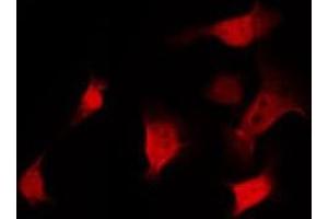 anti-Protein Phosphatase 2, Catalytic Subunit, alpha Isozyme (PPP2CA) (C-Term) antibody