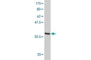 Western Blot detection against Immunogen (36. (LHX4 anticorps  (AA 208-306))