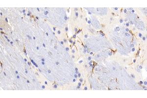 Detection of GFAP in Mouse Cerebrum Tissue using Monoclonal Antibody to Glial Fibrillary Acidic Protein (GFAP) (GFAP anticorps  (AA 70-374))