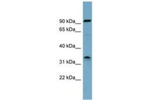 Image no. 1 for anti-serine Dehydratase (SDS) (AA 215-264) antibody (ABIN6743072) (serine Dehydratase anticorps  (AA 215-264))
