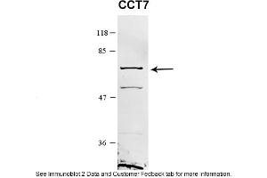 Sample Type: HEK 293 (10ug)Primary Dilution: 1:1000Secondary Antibody: conjugated goat anti-rabbitSecondary Dilution: 1:10,000Image Submitted By: Amy GrayBrigham Young University (CCT7 anticorps  (Middle Region))