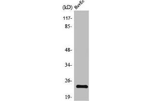 Western Blot analysis of HuvEc cells using TNF-IP 8 Polyclonal Antibody